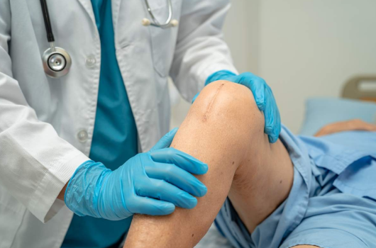 how to know if you need a knee replacement